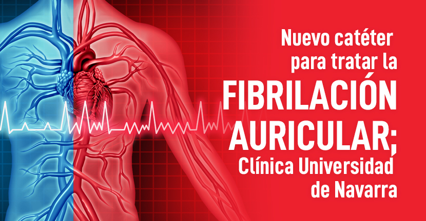 imagen del artículo Nuevo catéter para tratar la fibrilación auricular, Clínica Universidad de Navarra